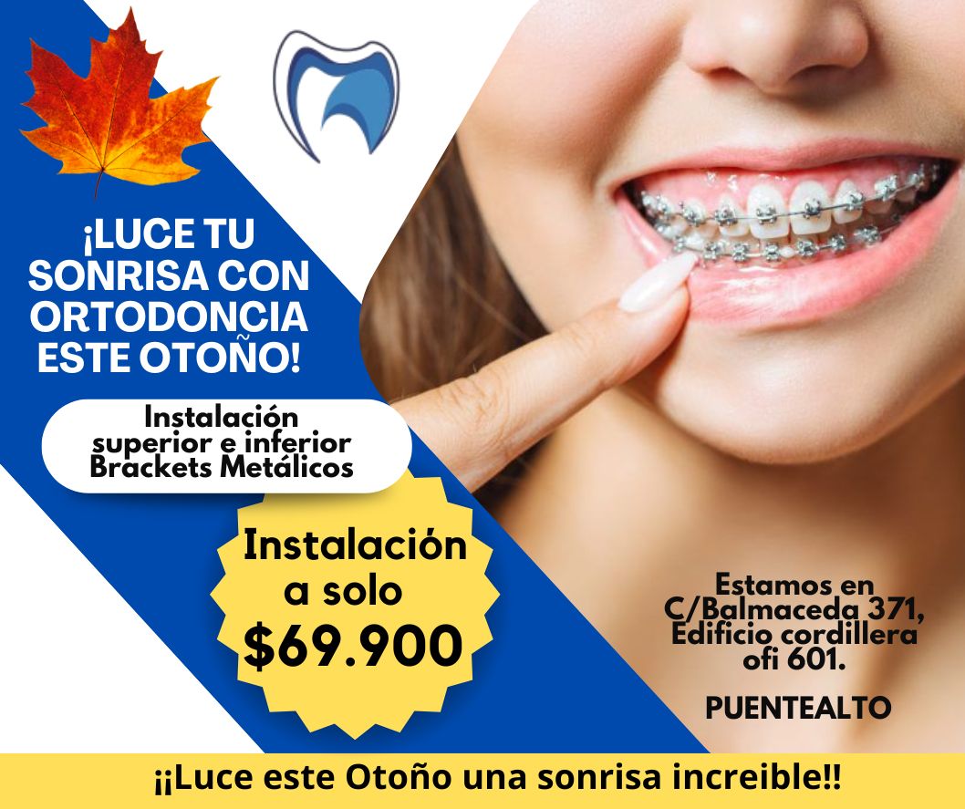 !!!!Ortodoncia  Promoción Instalación!!!!