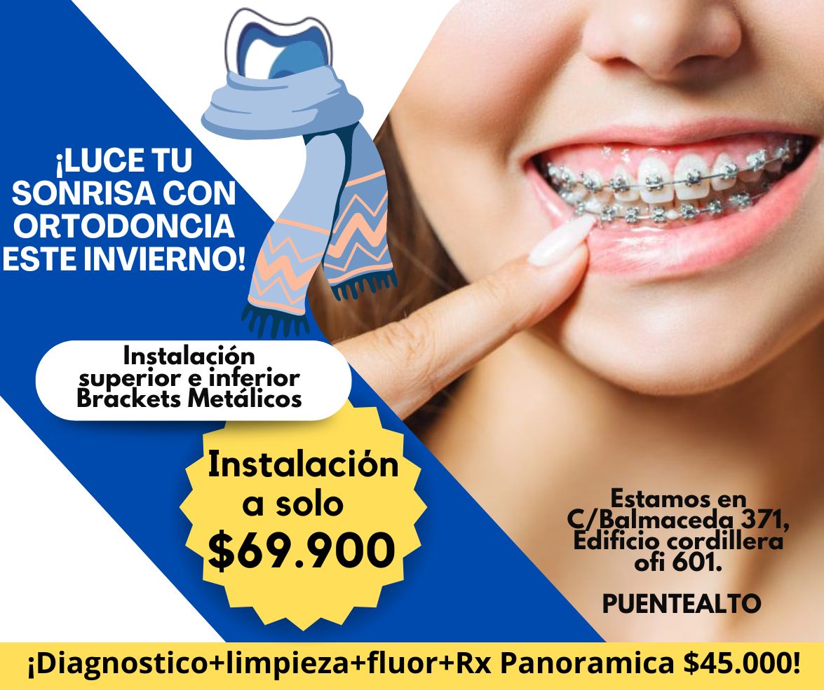!!!!Ortodoncia  Promoción Instalación!!!!