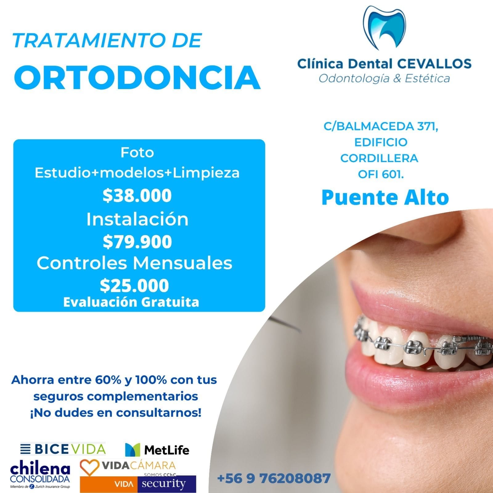 !!!!Ortodoncia  Promo Instalación Octubre!!!!